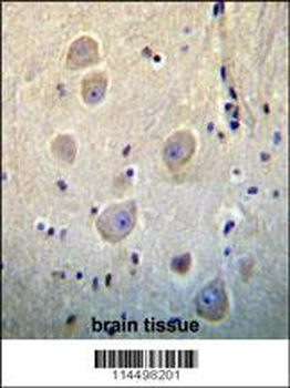 ARHB Antibody (Center)