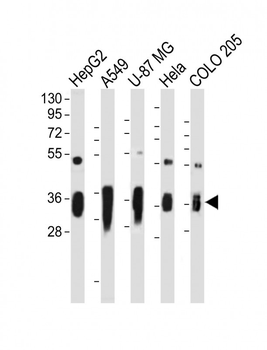 AKR1C2 Antibody (C-term)