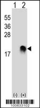 SUMO2/3 Antibody (N-term)