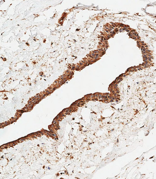 SMPD1 Antibody (C-term)