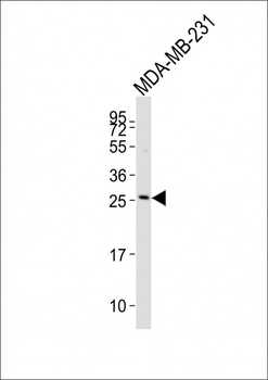 TCRB Antibody (Center)