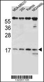 TCRB Antibody (Center)