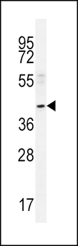 NEU2 Antibody (N-term)