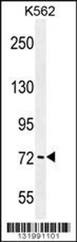 PAK6 Antibody (Center)