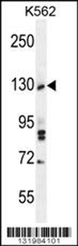 TTBK2 Antibody (N-term)