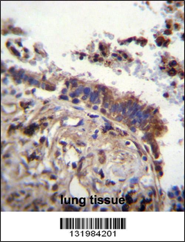 TTBK2 Antibody (N-term)