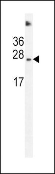SDHD Antibody (N-term)