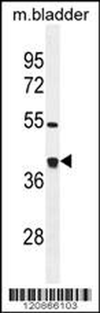 TXNL2 Antibody (N-term)