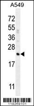CFD Antibody (N-term)
