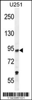 PCAF Antibody (C-term)