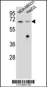 GLMN Antibody (C-term)