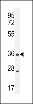 XCR1 Antibody (C-term)