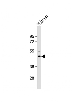 AP1M1 Antibody (Center)
