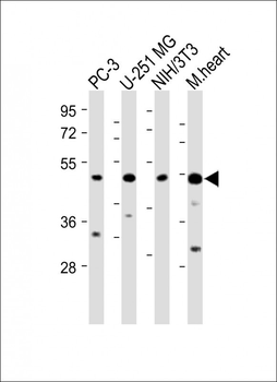 AP1M1 Antibody (Center)