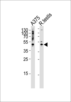 AP1M1 Antibody (Center)
