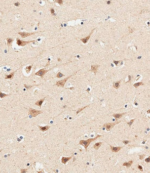 AP1M1 Antibody (Center)