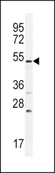 BMPR1B Antibody (Center)