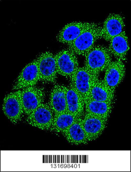 CPB1 Antibody (N-term)