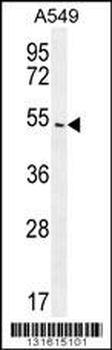 ARRB1 Antibody (C-term)