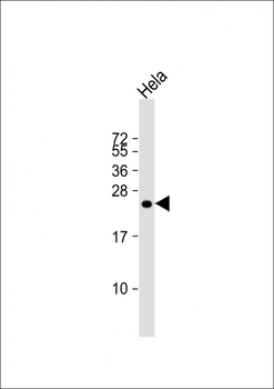 IL17B Antibody (Center)
