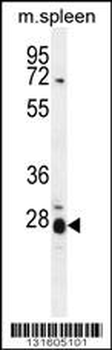 IL17B Antibody (Center)