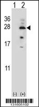 IL17B Antibody (Center)