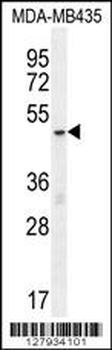 MeCP2 Antibody (N-term S80)