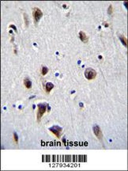 MeCP2 Antibody (N-term S80)