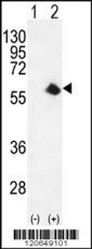 CDK8 Antibody (Center)