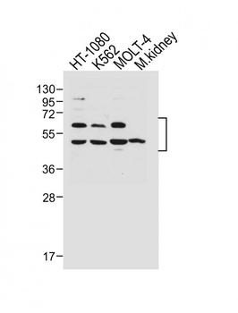 WT1 Antibody (Center E361)