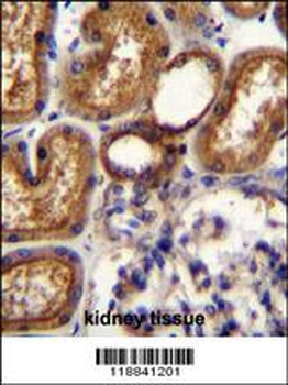 WT1 Antibody (Center E361)
