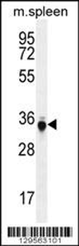 TP53INP1 Antibody (C-term)