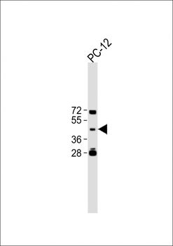 TBC1D13 Antibody (Center)