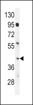 IRF9 Antibody (N-term)