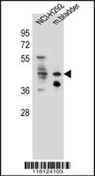 GHSR Antibody (C-term)