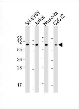 COL8A2 Antibody (C-term)