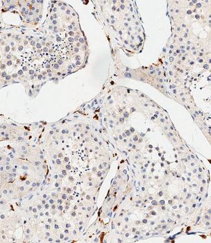 COL8A2 Antibody (C-term)