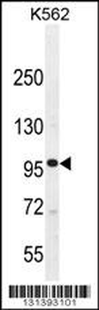 MYLK3 Antibody (Center)