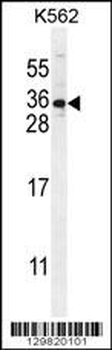 STARD6 Antibody (C-term)
