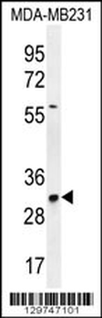 TNFAIP8L3 Antibody (Center)