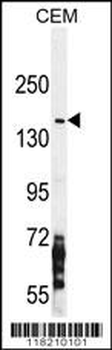 NOS2A Antibody (Center)