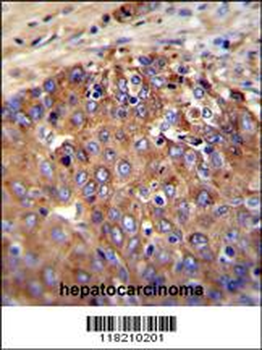NOS2A Antibody (Center)