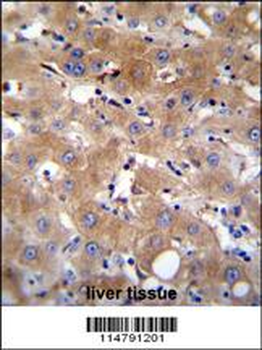 TRPM8 Antibody (Center)