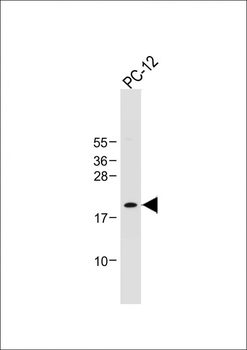 ID1 Antibody (Center)