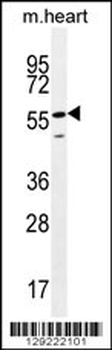 SMTNL2 Antibody (N-term)
