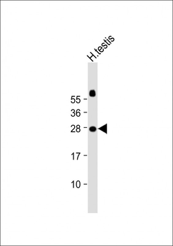 JAZF1 Antibody (N-term)