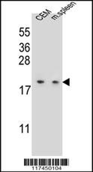LSM7 Antibody (C-term)