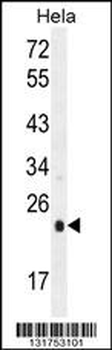UQCRFS1 Antibody (C-term)