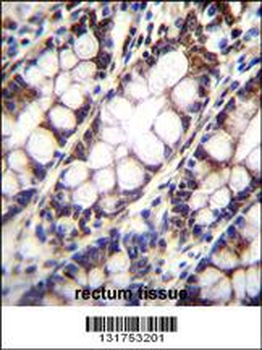 UQCRFS1 Antibody (C-term)