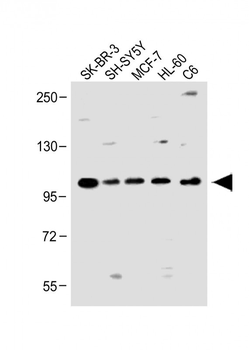 PCDH20 Antibody (Center)